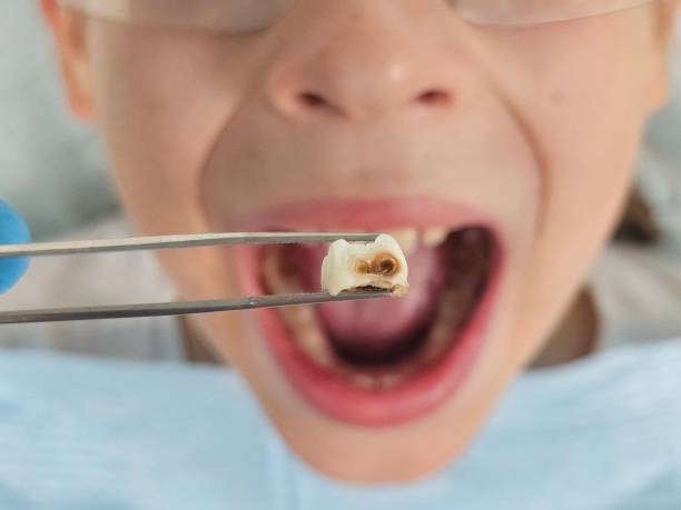 Best Emergency Denture Repair in Cumberland, IN